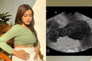 Brisia Jodie Buka Suara Soal Tudingan Netizen yang Menyebutnya Hamil: Nih Tadi Abis USG...