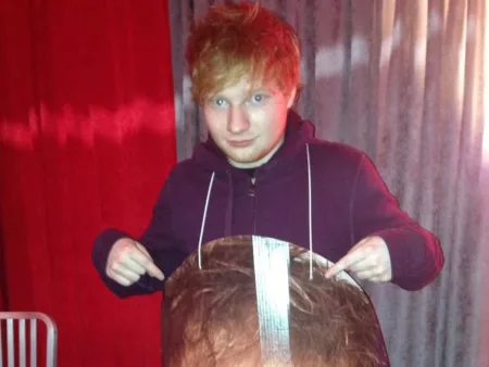 Ed Sheeran Unggah Foto Lama Dalam Perayaan Single Baru (@teddysphotos)