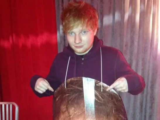 Ed Sheeran Unggah Foto Lama Dalam Perayaan Single Baru (@teddysphotos)