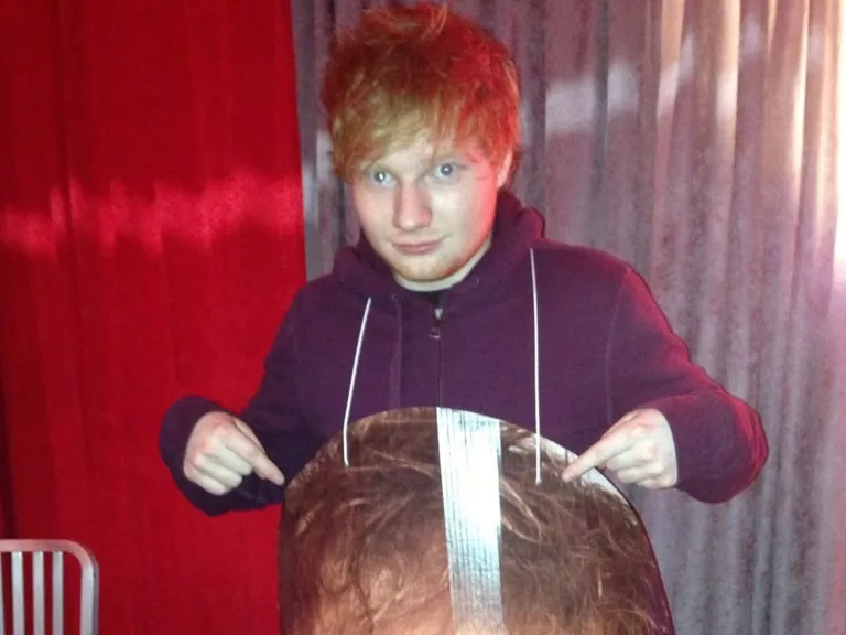 Ed Sheeran Unggah Foto Lama Dalam Perayaan Single Baru (@teddysphotos)