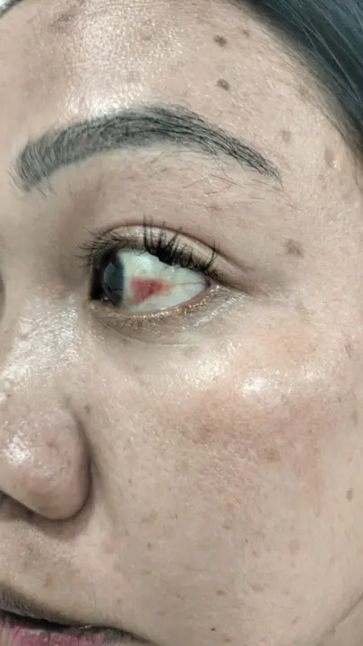 Diduga Dianiaya Saat Antre di SPBU, Seorang Wanita di Karawang Lapor Polisi tapi Tak Kunjung Diproses