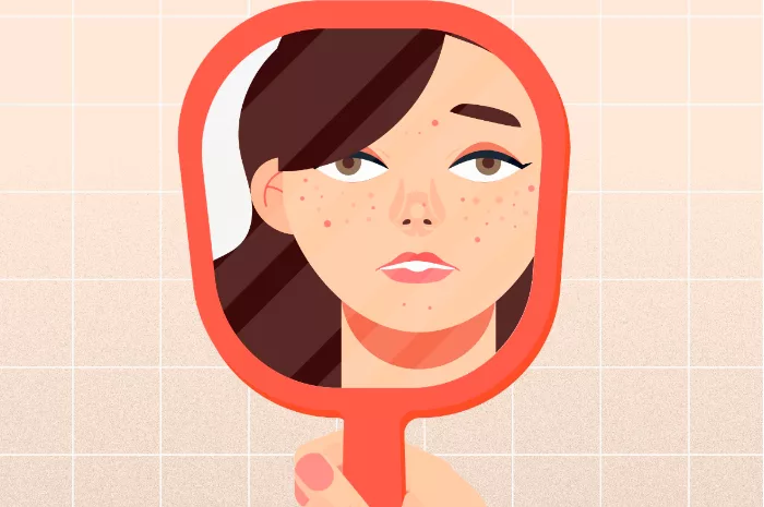 Ganggu Penampilan? Ini Dia Cara Menghilangkan Milia Bintik Putih yang Membandel di Wajah