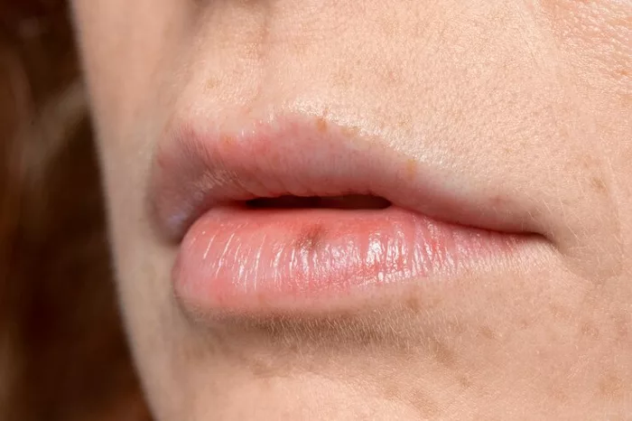 Bikin Gak Nyaman! Yuk, Cegah Kondisi Bibir Kering dengan Bahan Alami Ini